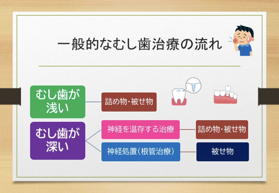 大垣市の歯医者、ビバ・スマイル歯科のむし歯治療